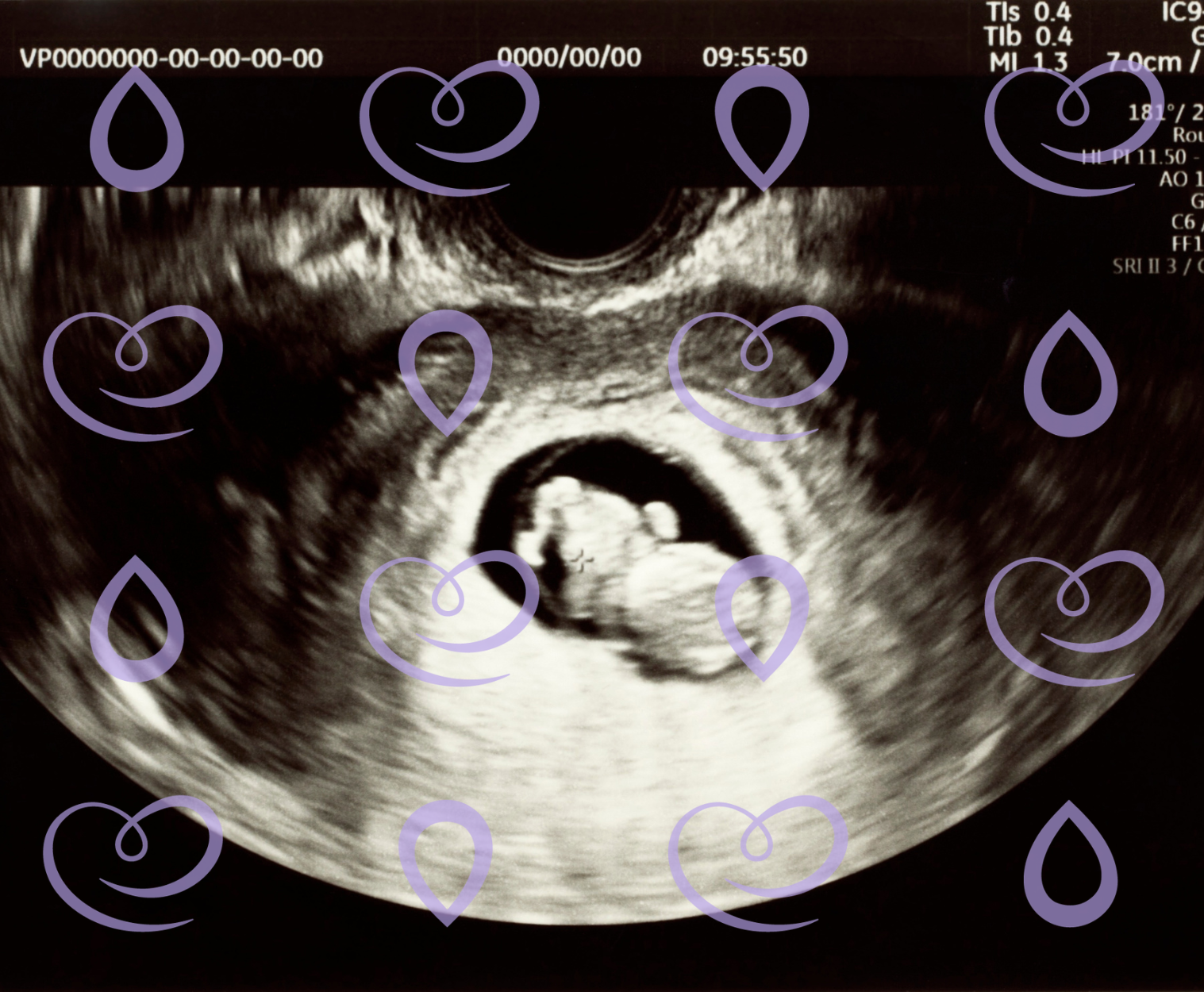 primeiro trimestre da gravidez