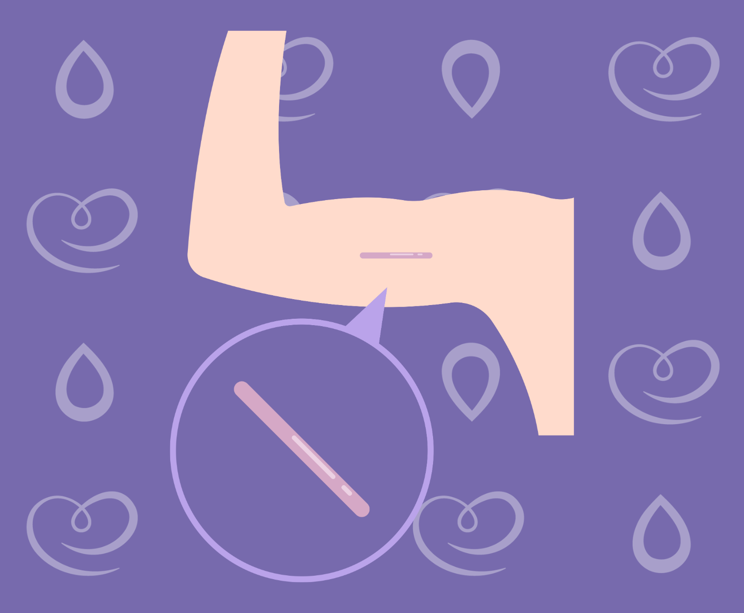 benefícios do Implanon