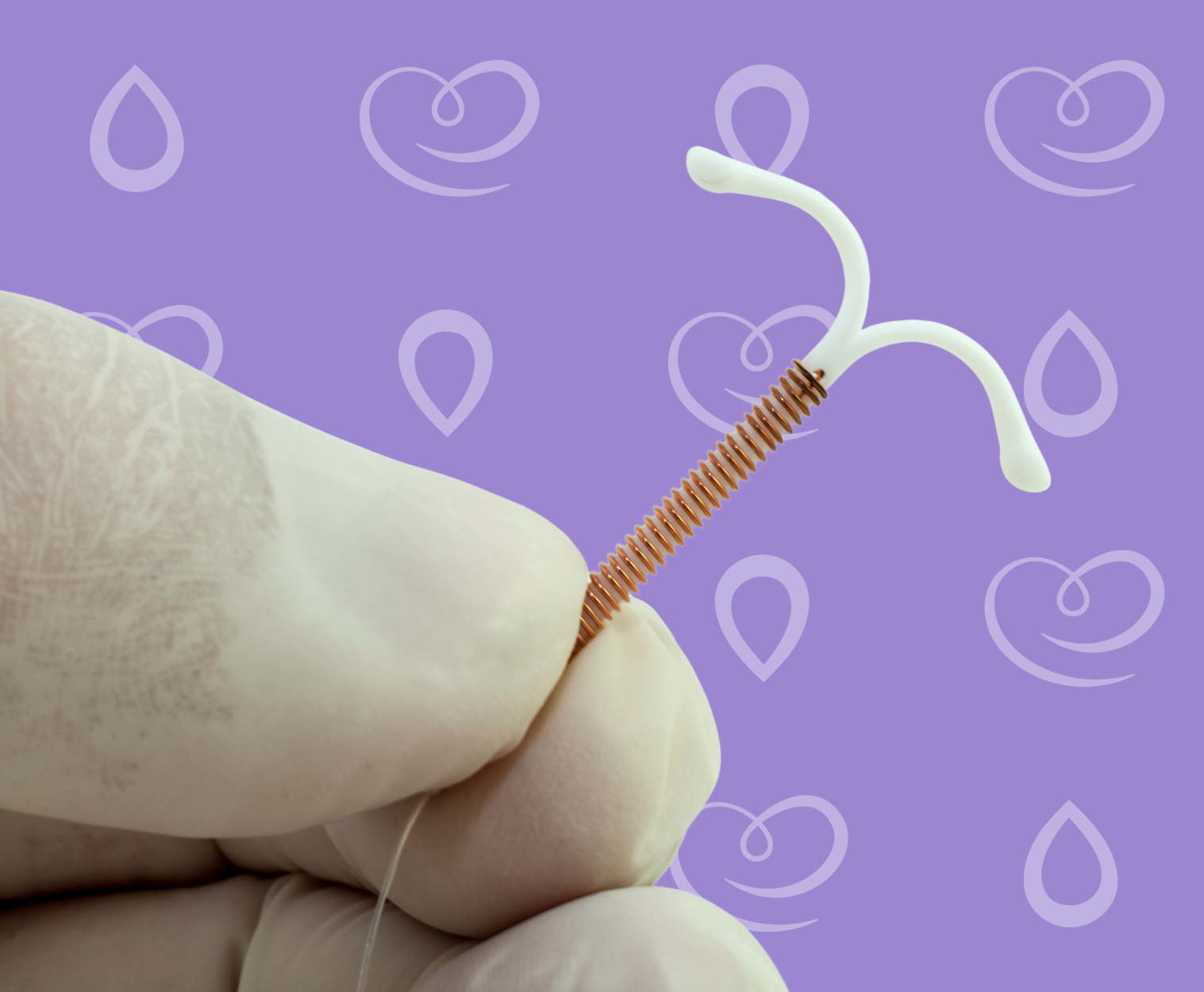 inserção de DIU com sedação