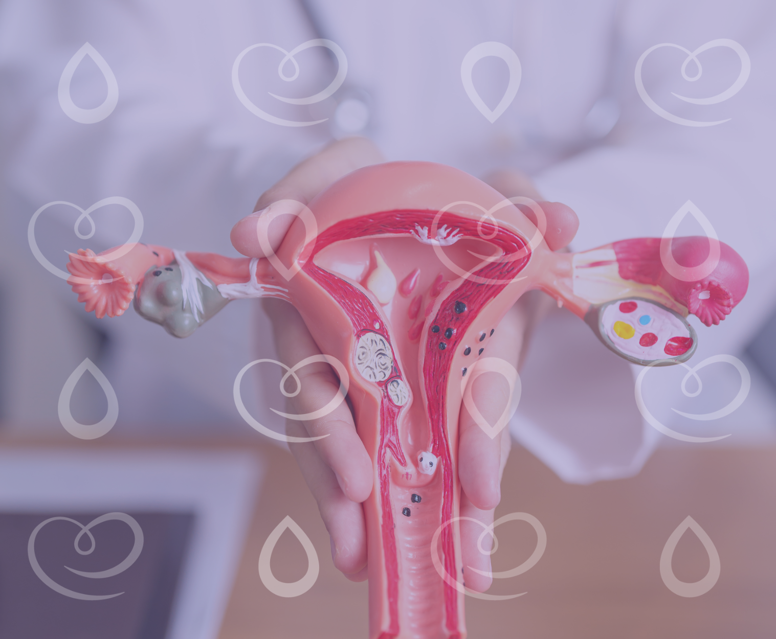 candidíase de repetição