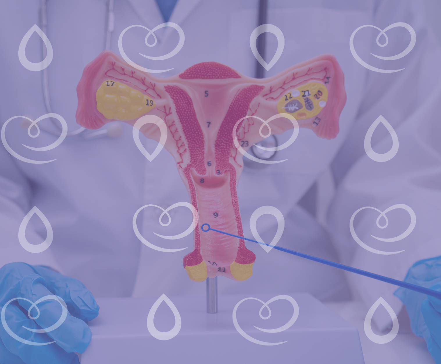 candidíase de repetição